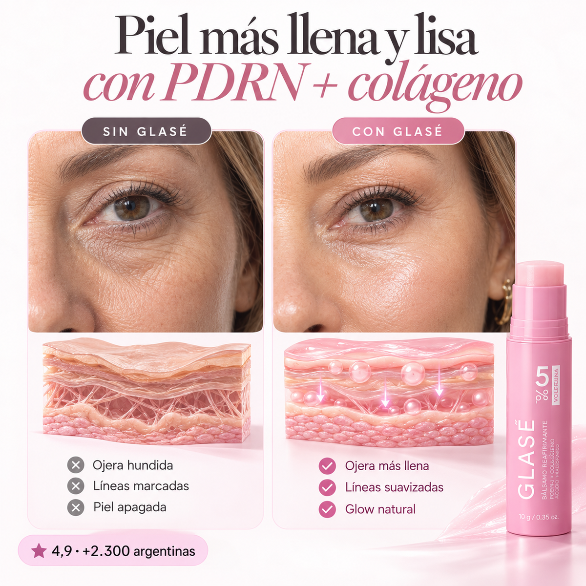 GLASÉ – Bálsamo coreano que rellena ojeras y líneas al instante