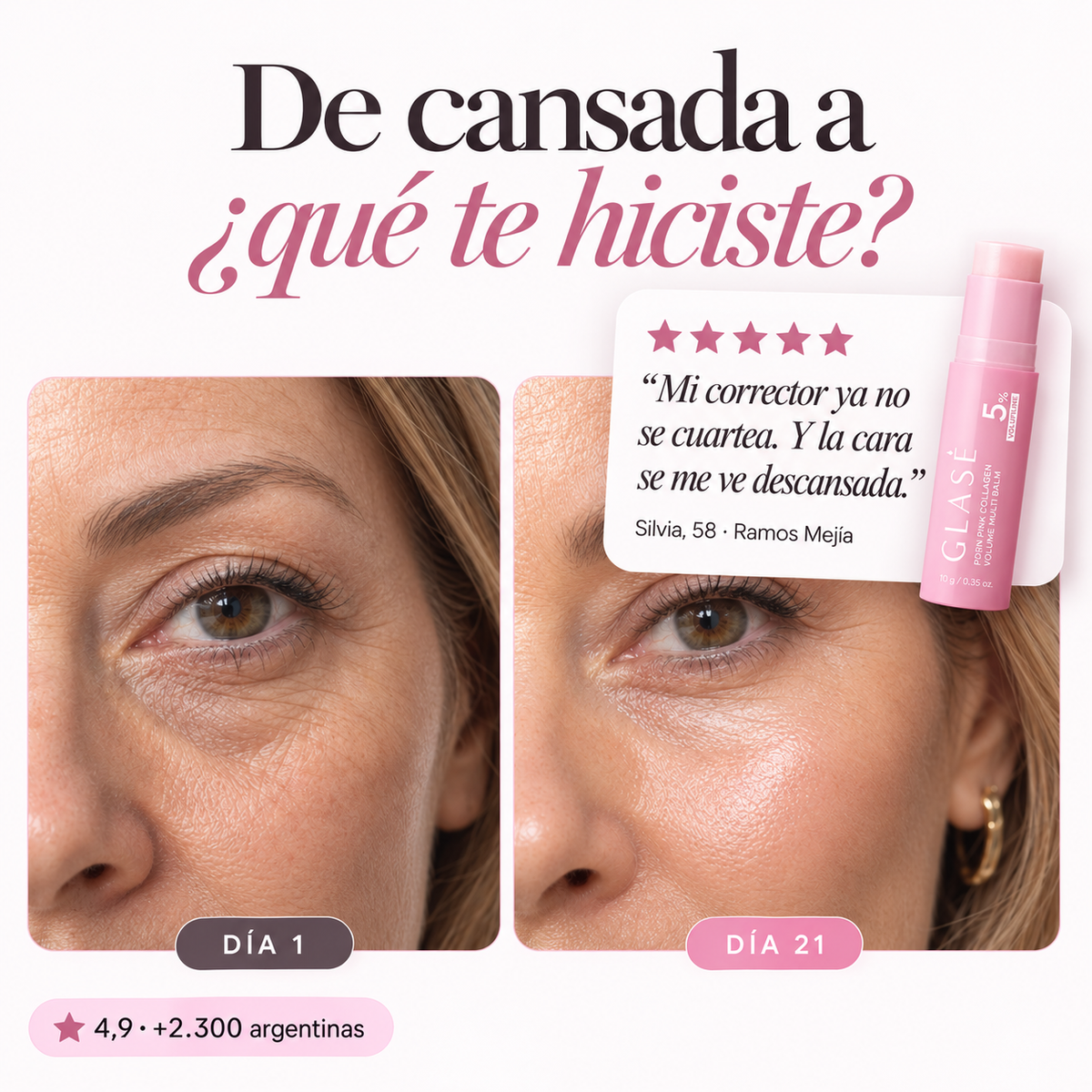 GLASÉ – Bálsamo coreano que rellena ojeras y líneas al instante